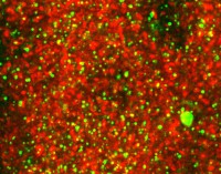 /album/fotogaleria-medium-spiny-neuron-labeled-with-dii-and-genegun/sp5-factin-reed-adducin-green02-copia-jpg/